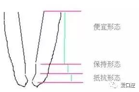 牙胶尖什么颜色根管治疗的标准步骤以及治疗细节的把握_https://www.jmylbn.com_新闻资讯_第5张