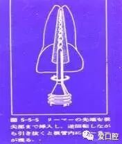 根管治疗标准步骤和细节把握