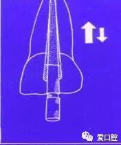 牙胶尖什么颜色根管治疗的标准步骤以及治疗细节的把握_https://www.jmylbn.com_新闻资讯_第16张