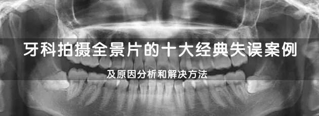 口腔冲洗液怎么喷牙科临床根管冲洗液次氯酸钠使用心得_https://www.jmylbn.com_新闻资讯_第8张
