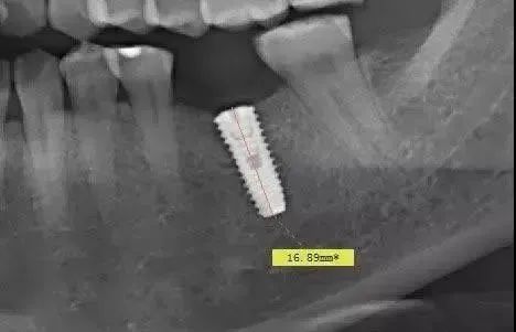 警惕全景片的放大率