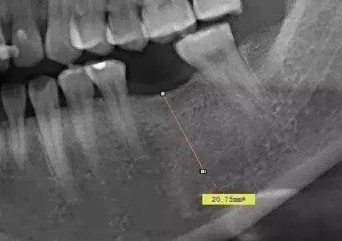 警惕全景片的放大率