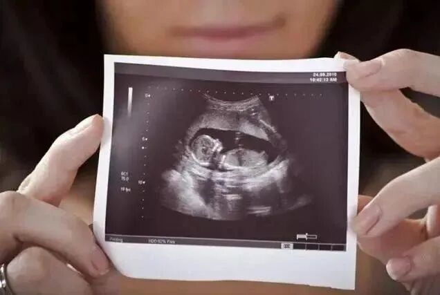 汕头彩超怎么样孕期做四维彩超发现宝宝竟是大长腿？你的关心用错了地方！｜ 汕头妇产科医院_https://www.jmylbn.com_新闻资讯_第7张