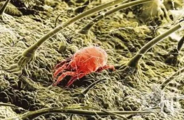 我们的头皮充满了毒素？