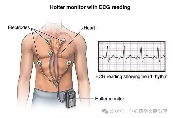 什么是动态心电图频域动态心电图的心率变异性怎么看-上海聚慕医疗器械有限公司