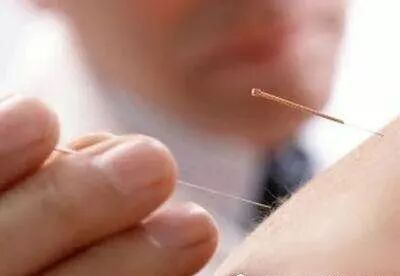 电位疏导器怎么使用高树中针药并用辨治疑难病案三则_https://www.jmylbn.com_新闻资讯_第2张