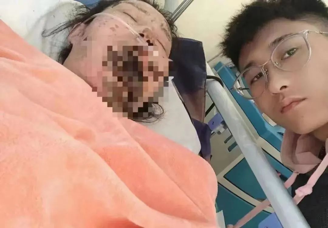 家暴纵火案儿子跟父亲家亲戚断联