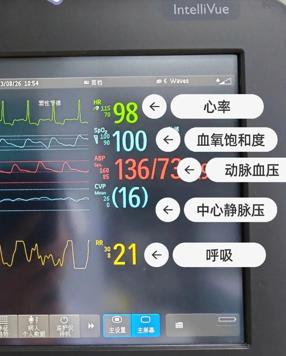 心电监护仪怎么看图解心电监护仪的使用宣教_https://www.jmylbn.com_新闻资讯_第4张