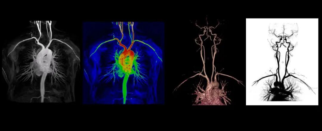 联影磁共振怎么样更先进、更高效、更精准—联影3.0T超导磁共振落户武城县人民医院_https://www.jmylbn.com_新闻资讯_第15张