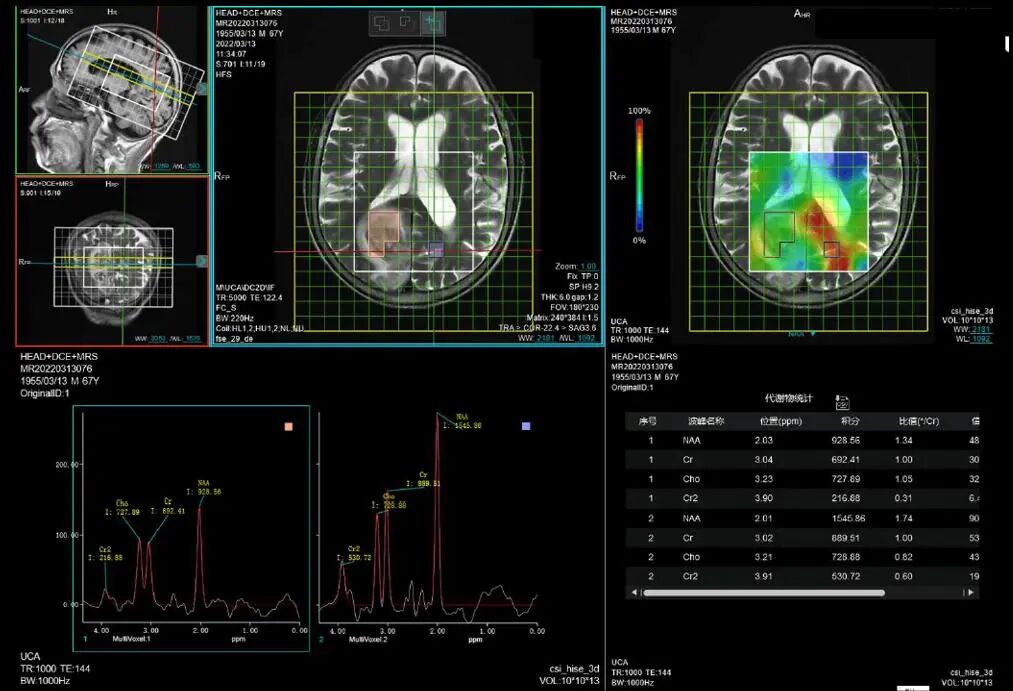 联影磁共振怎么样更先进、更高效、更精准—联影3.0T超导磁共振落户武城县人民医院_https://www.jmylbn.com_新闻资讯_第20张