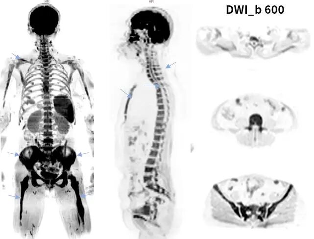 联影磁共振怎么样更先进、更高效、更精准—联影3.0T超导磁共振落户武城县人民医院_https://www.jmylbn.com_新闻资讯_第18张