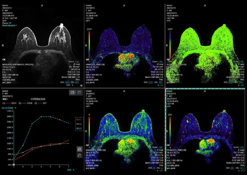 联影磁共振怎么样更先进、更高效、更精准—联影3.0T超导磁共振落户武城县人民医院_https://www.jmylbn.com_新闻资讯_第19张