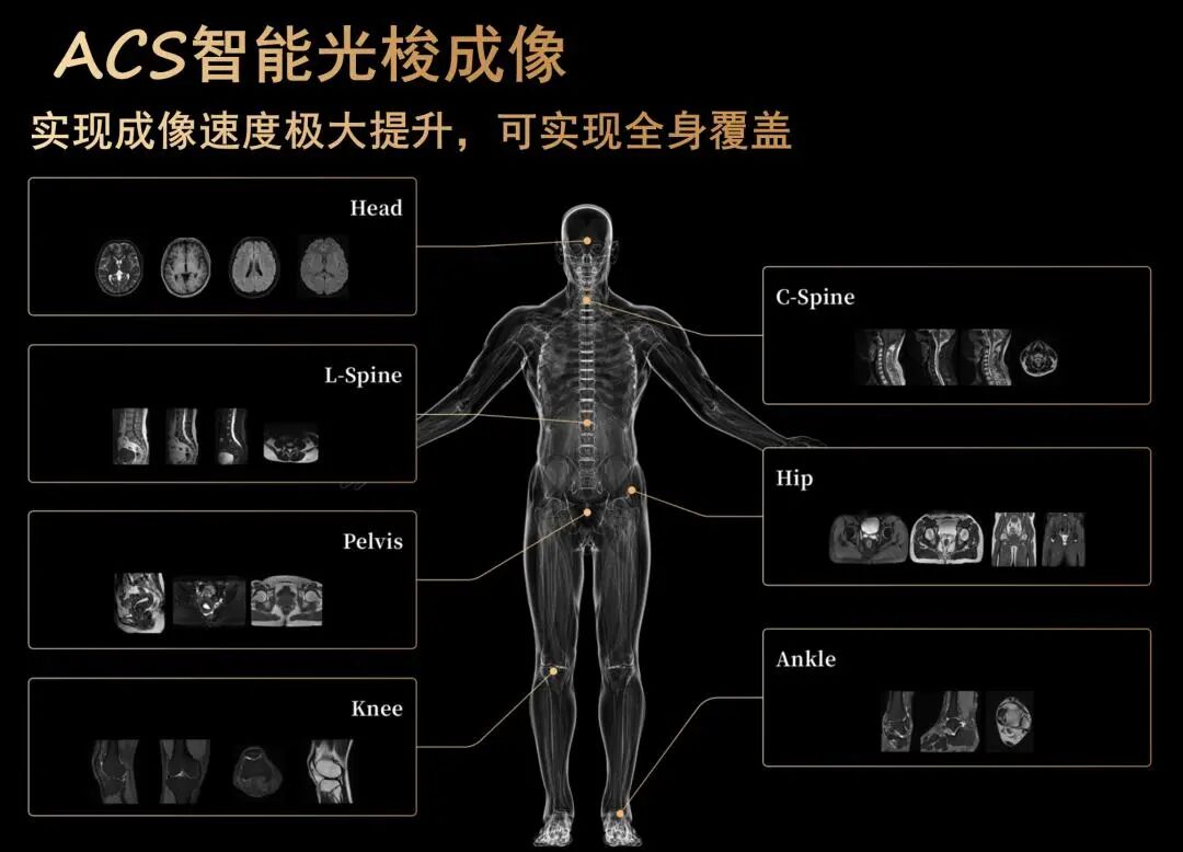 联影磁共振怎么样更先进、更高效、更精准—联影3.0T超导磁共振落户武城县人民医院_https://www.jmylbn.com_新闻资讯_第12张