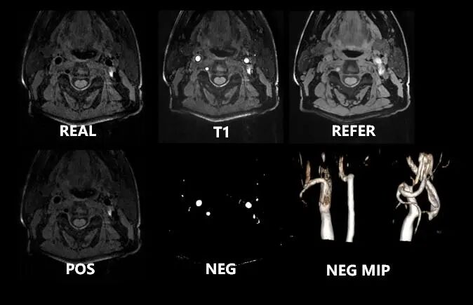 联影磁共振怎么样更先进、更高效、更精准—联影3.0T超导磁共振落户武城县人民医院_https://www.jmylbn.com_新闻资讯_第14张