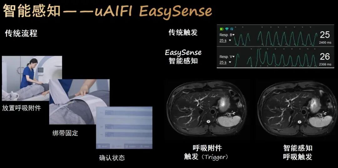 联影磁共振怎么样更先进、更高效、更精准—联影3.0T超导磁共振落户武城县人民医院_https://www.jmylbn.com_新闻资讯_第10张