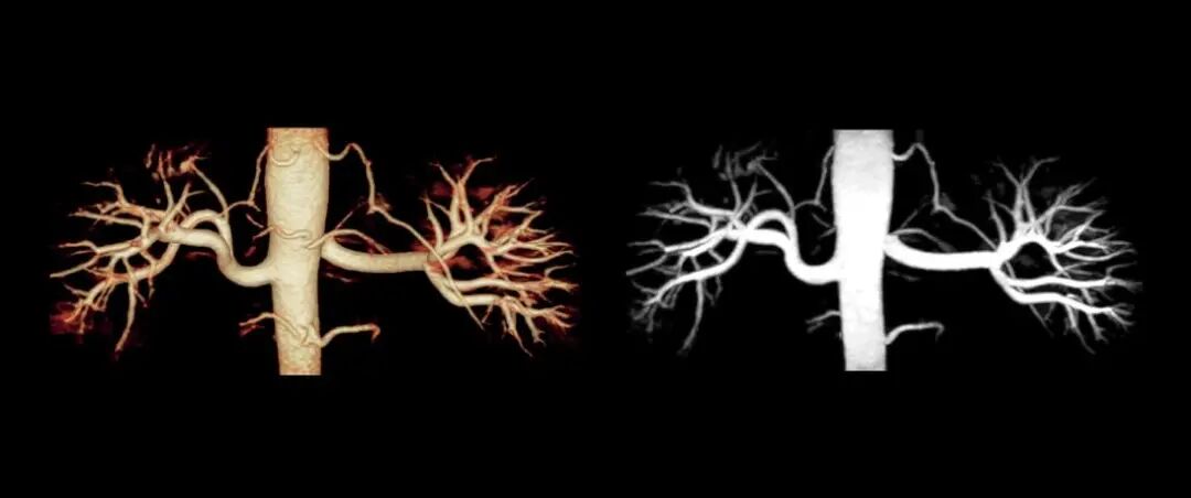 联影磁共振怎么样更先进、更高效、更精准—联影3.0T超导磁共振落户武城县人民医院_https://www.jmylbn.com_新闻资讯_第16张