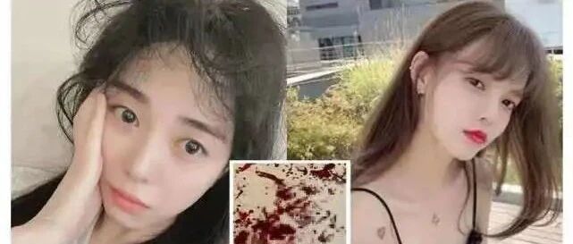 韩女星再曝遭施暴辱骂!队友带异性进宿舍被看光，割腕自杀超过20次?