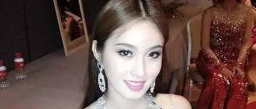 继金星后又一男星变形成功，手术后疼的满地爬，如今比杨颖还美