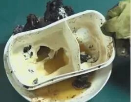 微波炉为什么不能用金属器皿_微波炉可用金属容器_微波炉可以用金属器具吗