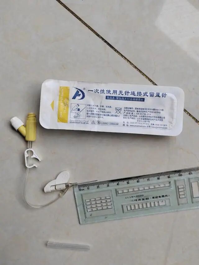 留置针怎么取出男婴输液时针头导管留体内5年，最近进展：已取出_https://www.jmylbn.com_新闻资讯_第3张