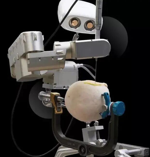 【见多识广】扒一扒工业机器人的核心部件--精密减速机的图1