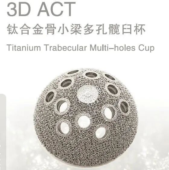 【科技前沿】3D打印钛合金人体骨骼，原来“换骨”术早就有了的图6