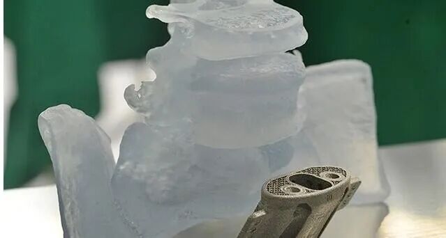 【科技前沿】3D打印钛合金人体骨骼，原来“换骨”术早就有了的图3