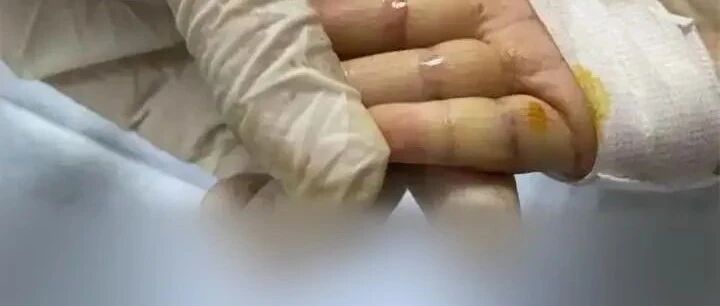 2岁女童反复患上肺炎，瘦得让人可怜！爸爸说出一个“秘密”，妈妈绷不住了……