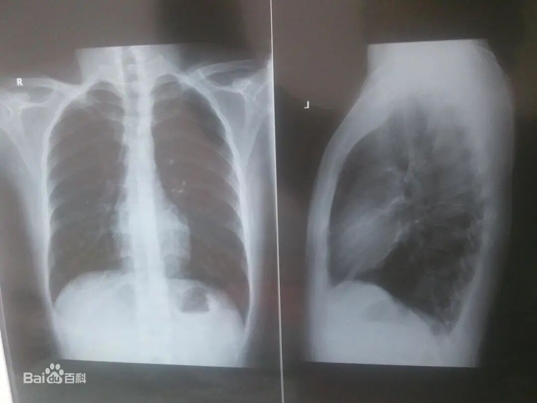 x光机为什么为什么要用x光来找毒蛇呢？本周孩子们好奇的问题还有…【把世界讲给孩子听】_https://www.jmylbn.com_新闻资讯_第2张