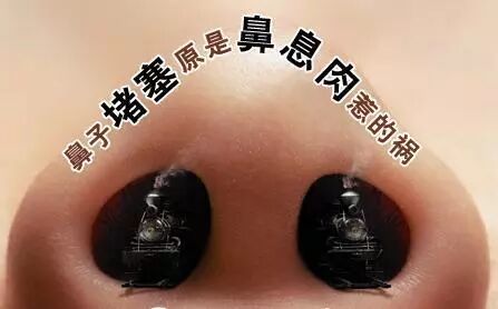 夏季鼻息肉高发，如何预防好？