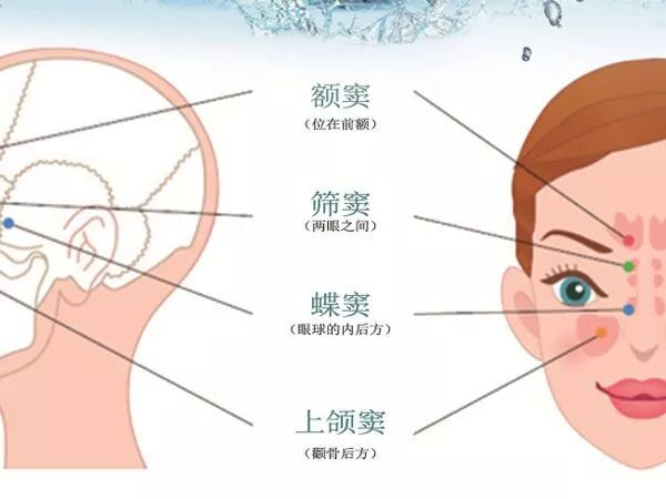 鼻窦炎为何如此“青睐”你的孩子？