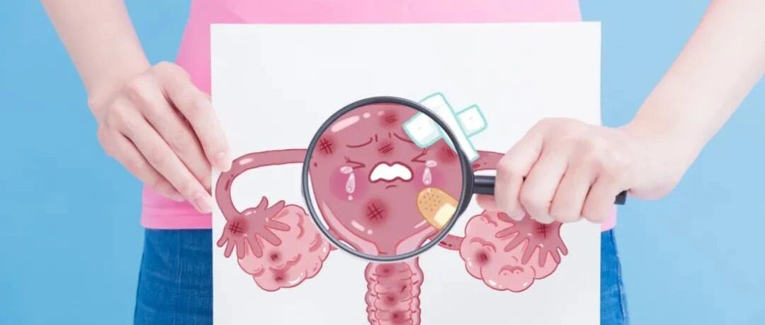 哪些子宫肌瘤需要被切除