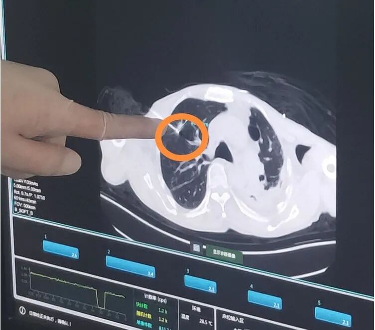 氦氩刀是什么氩氦刀冷冻消融术——延续生命的法宝_https://www.jmylbn.com_新闻资讯_第8张