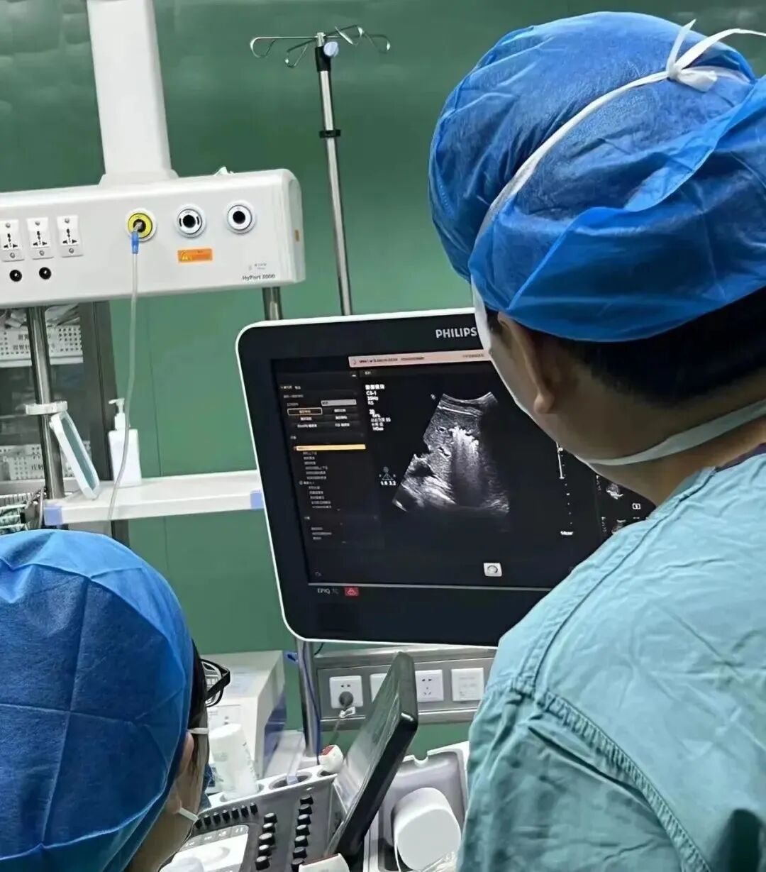 微波针是什么“针尖”上的手术： 微波消融术治疗甲状腺疾病_https://www.jmylbn.com_新闻资讯_第5张