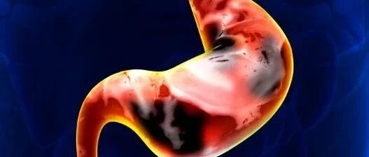 一线治疗胃癌，百济神州PD-1抗体组合疗法达到68.2%缓解率