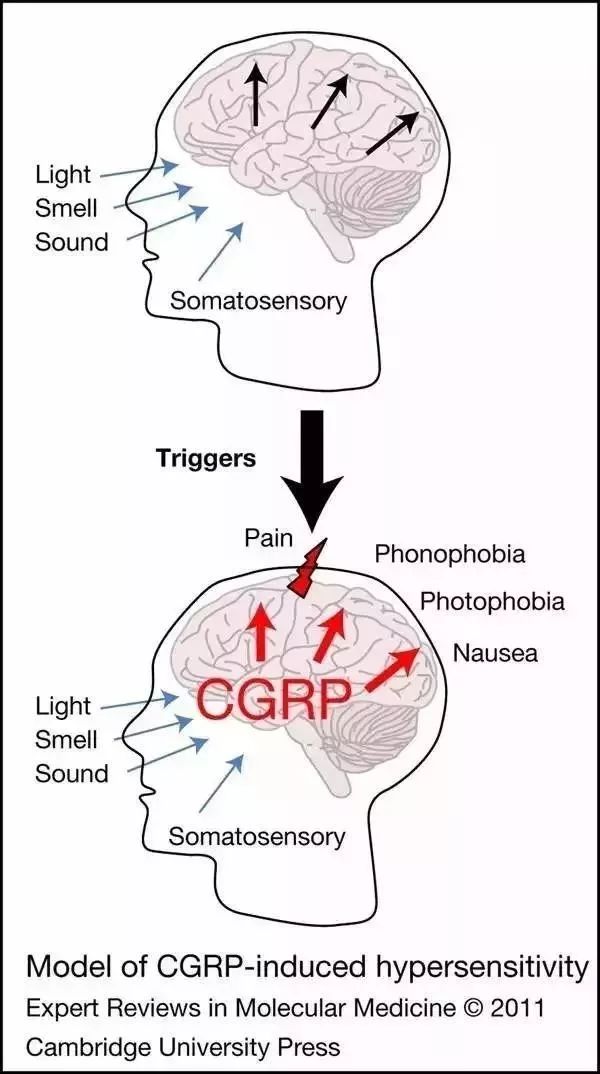 里程碑！首款口服小分子CGRP受體抑制劑今日獲批治療偏頭痛 健康 第2張