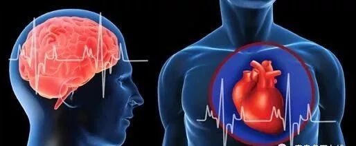 預防心腦血管疾病，採訪專家這樣建議！ 健康 第2張