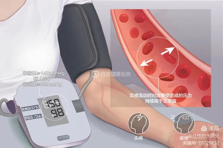 动态血压器怎么看【妇幼科普】“动态血压监测仪”，真实了解“您”的血压_https://www.jmylbn.com_新闻资讯_第6张