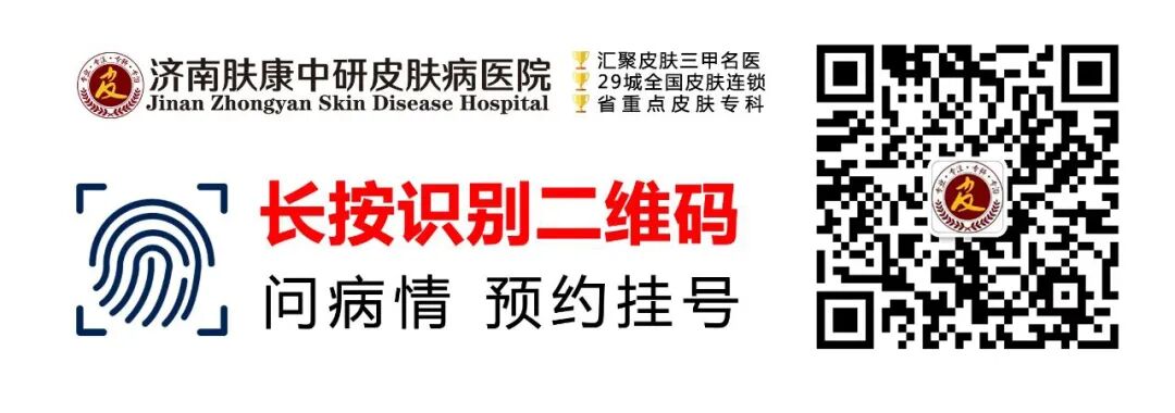 斑秃是什么原因造成的-女性掉发严重的原因及解决方法-济南看脱发的医院-济南段店看皮肤病医院地址-济南肤康皮肤病研究所「预约挂号」