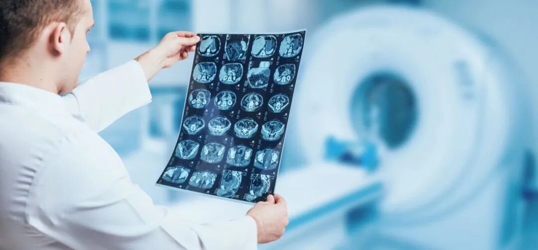 体检dr是什么意思X光片（DR）、CT、核磁（MRI）检查有什么区别？_https://www.jmylbn.com_新闻资讯_第7张