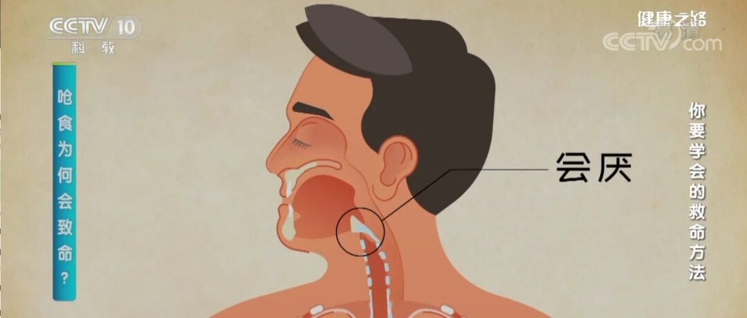护士早读 |关键时刻可以救命的方法——海姆立克急救