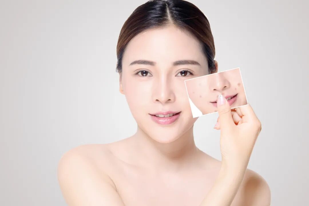 轻医美抗衰有副作用吗(轻医美抗衰有副作用吗女性)