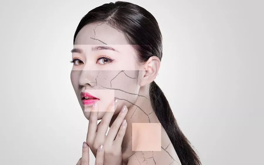 什么是光电治疗青春定格，科技逆龄——光电美肤！_https://www.jmylbn.com_新闻资讯_第6张