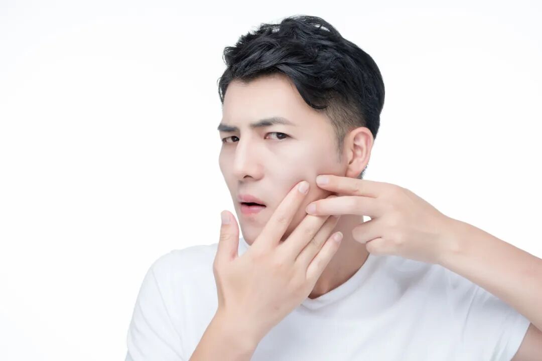 二氧化碳(co2)激光治疗是什么二氧化碳（CO₂）点阵激光，除了治疗痘坑还有哪些功能？_https://www.jmylbn.com_新闻资讯_第9张