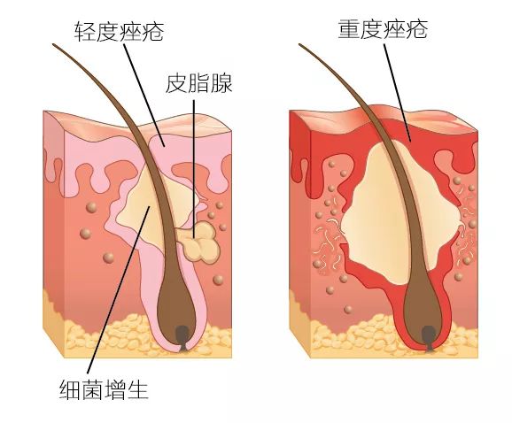 护肤心得十年经验怎么写_十年护肤经验护肤心得_护肤经验分享心得