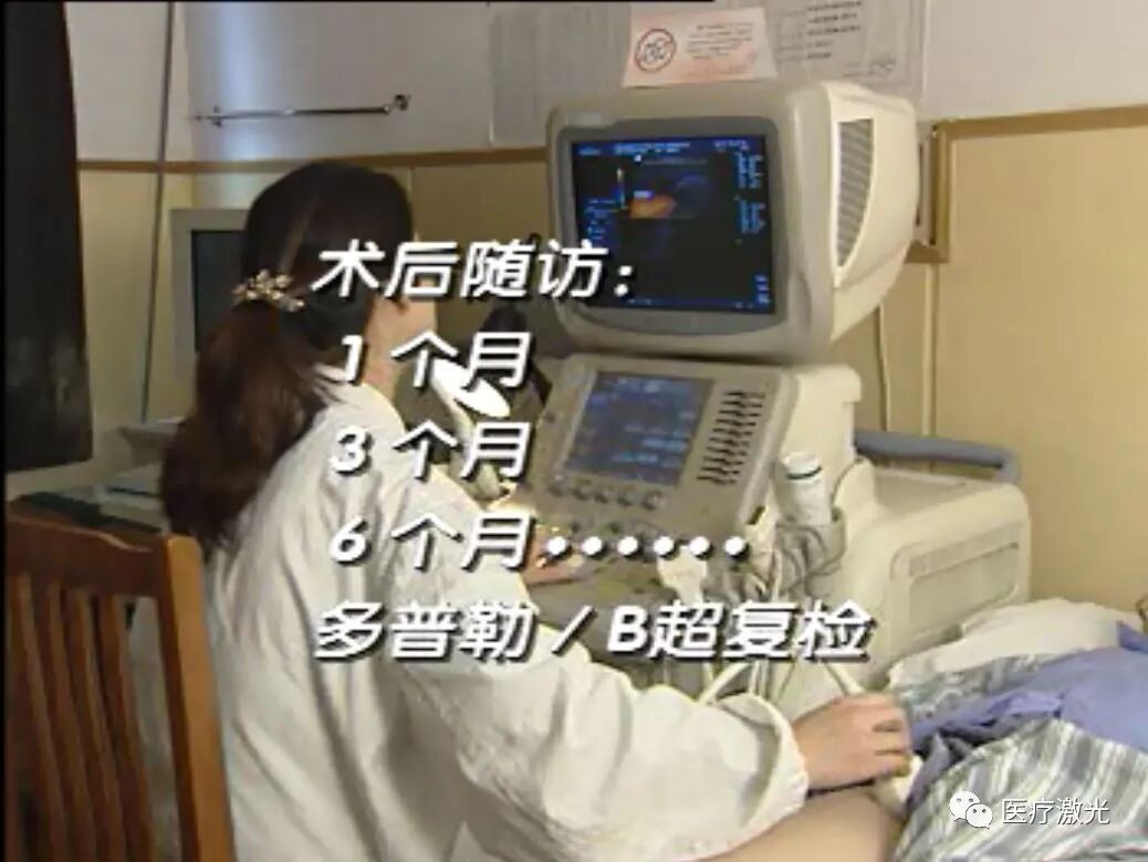 光纤什么手术【激光微创】静脉曲张激光微创手术操作流程_https://www.jmylbn.com_新闻资讯_第13张