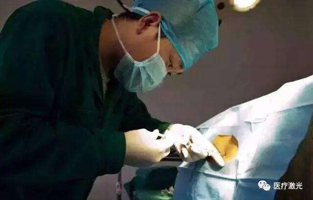 光纤什么手术【激光微创】静脉曲张激光微创手术操作流程_https://www.jmylbn.com_新闻资讯_第7张