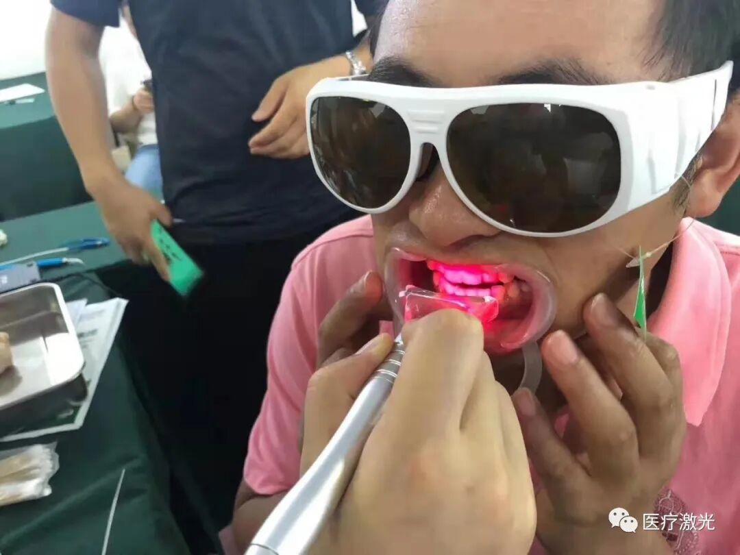 口腔激光有哪些牌子中国口腔激光市场的三重驱动与未来图景_https://www.jmylbn.com_新闻资讯_第2张