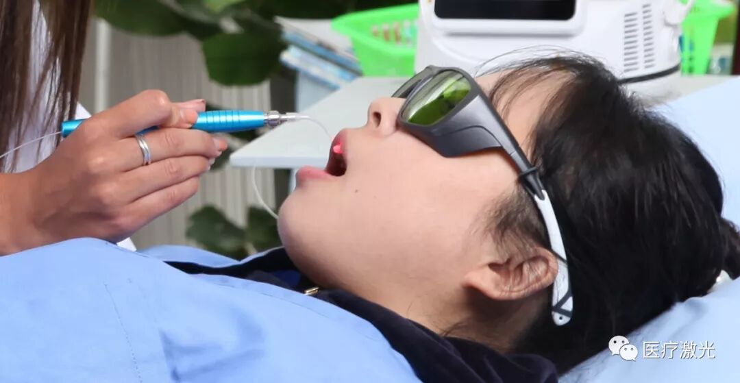 口腔激光有哪些牌子中国口腔激光市场的三重驱动与未来图景_https://www.jmylbn.com_新闻资讯_第1张