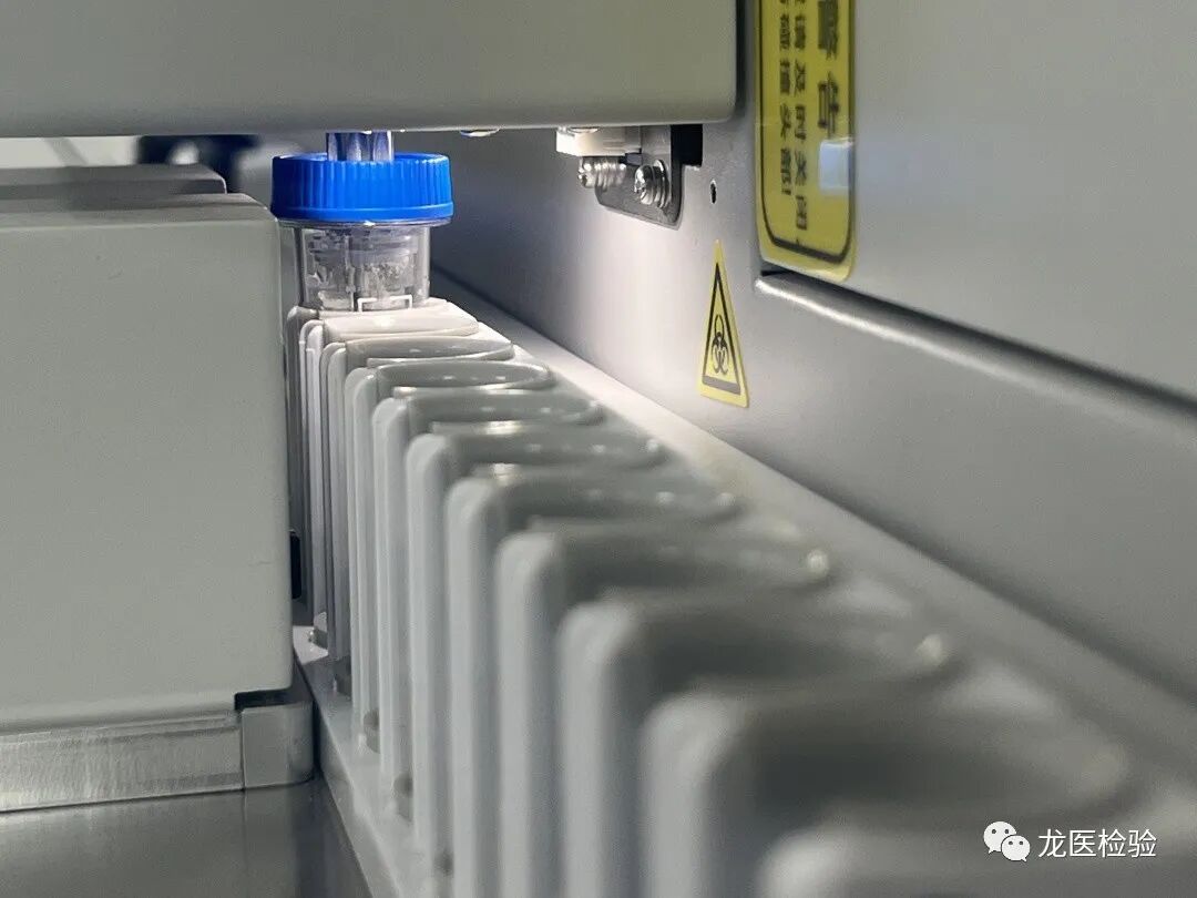 大便分析仪怎么用快看！！！全自动粪便分析仪来了_https://www.jmylbn.com_新闻资讯_第4张